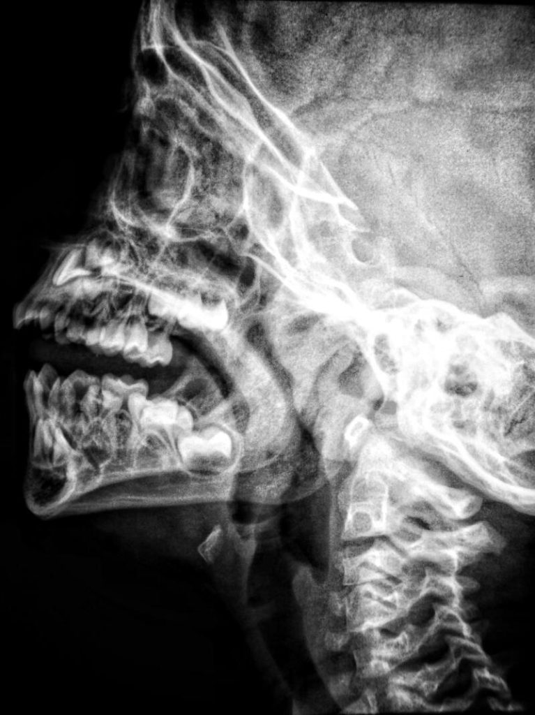 Teleradiologia – szyta na miarę XXI wieku.